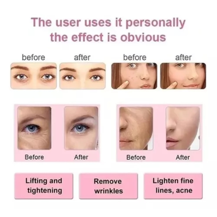 Miniatura 4 de Masajeador Ultrasonido Cavitación *Kalo